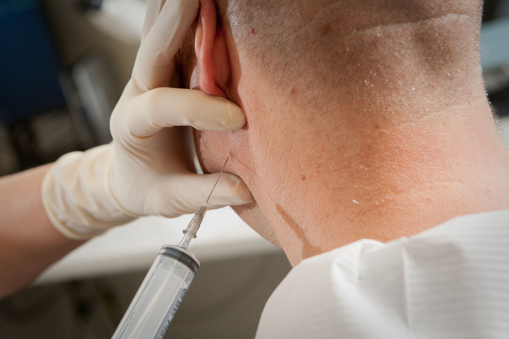 cytologische-punctie image Punctie cytologische punctie