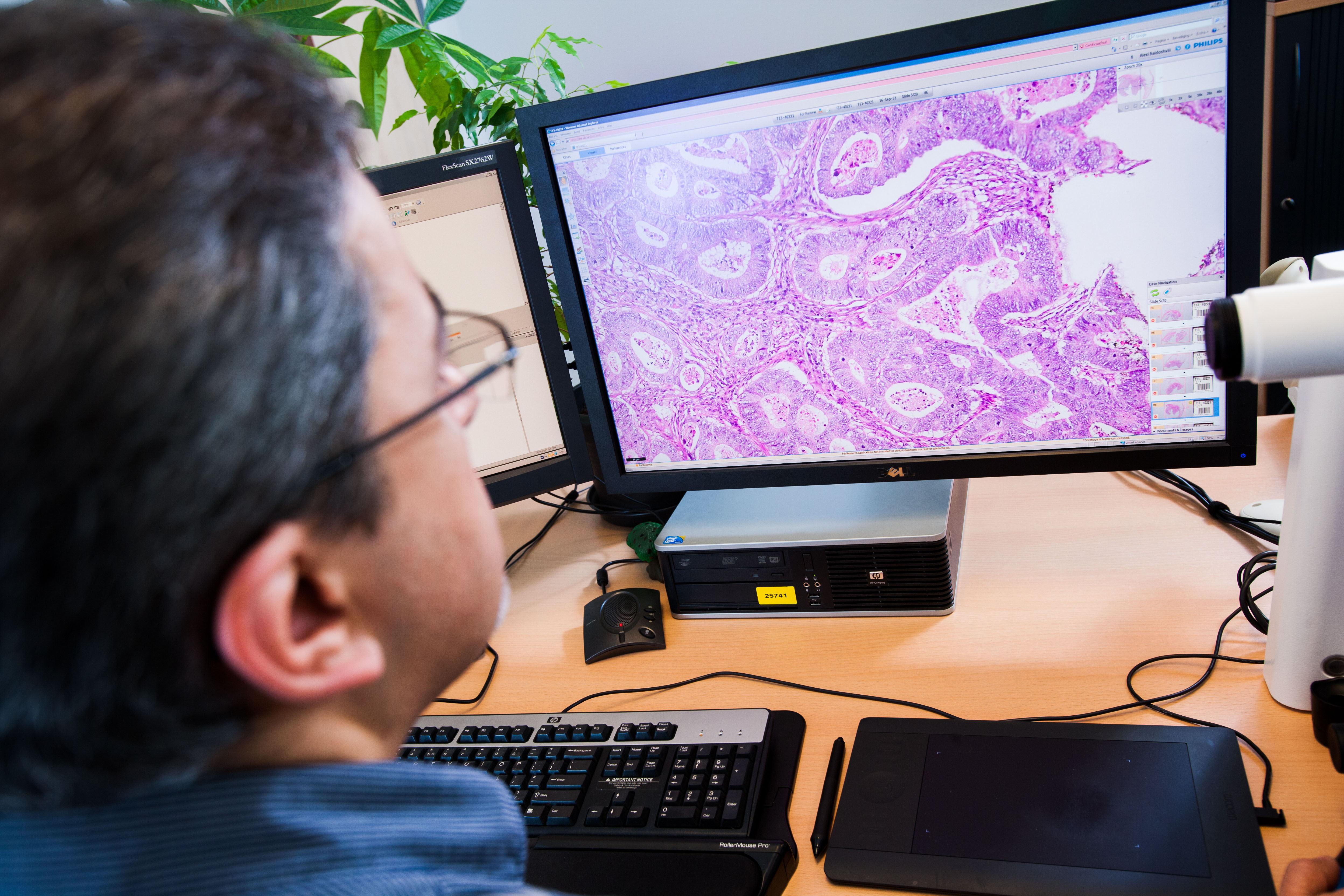 20140114_0050 image Startpagina Laboratorium Pathologie Oost Nederland 20140114_0050 Startpagina Laboratorium Pathologie Oost Nederland