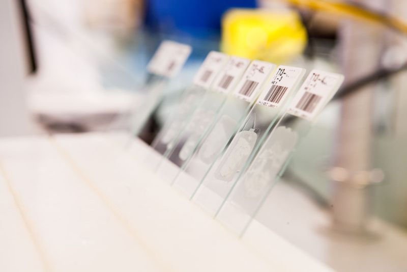 opgesleepte-coupes-op-objectglaasje-labpon-1c3b69fb image Histologie opgesleepte-coupes-op-objectglaasje-labpon-1c3b69fb Histologie