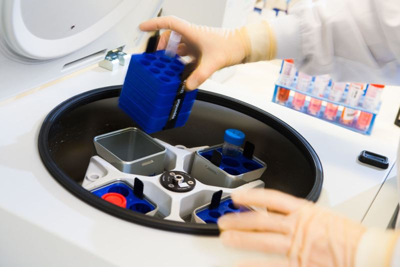 plaatsen-in-centrifuge-labpon-8f9b3cf4 image Cytologie plaatsen-in-centrifuge-labpon-8f9b3cf4 Cytologie