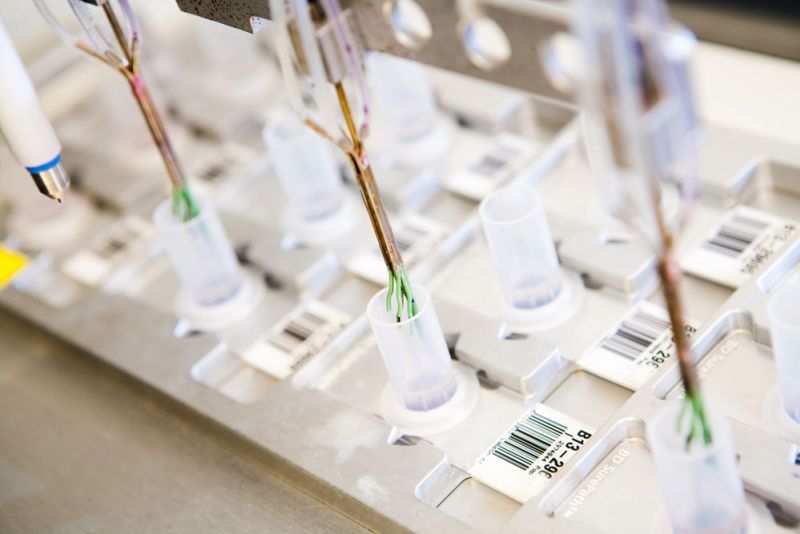 pap-kleuren-preparaten-prepstain-labpon-ab94ba5c image Onderzoek baarmoederhalskanker pap-kleuren-preparaten-prepstain-labpon-ab94ba5c Onderzoek baarmoederhalskanker
