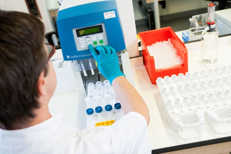 scheiden-bloed-slijm-prepmate-labpon-1d9778db image Onderzoek baarmoederhalskanker scheiden-bloed-slijm-prepmate-labpon-1d9778db Onderzoek baarmoederhalskanker