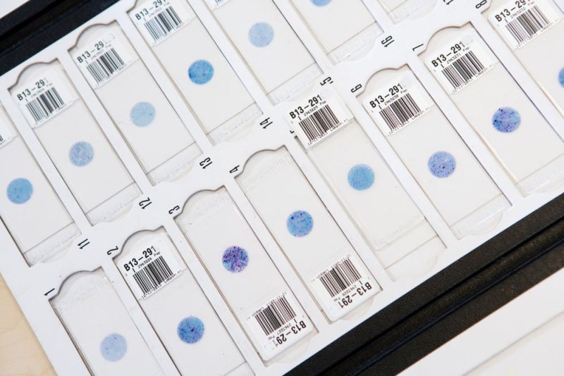 pap-gekleurde-cytologische-preparaten-labpon-451f77f3 image Onderzoek baarmoederhalskanker pap-gekleurde-cytologische-preparaten-labpon-451f77f3 Onderzoek baarmoederhalskanker