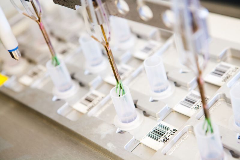 pap-kleuren-preparaten-prepstain-labpon-4cd16cc5 image Onderzoek baarmoederhalskanker pap-kleuren-preparaten-prepstain-labpon-4cd16cc5 Onderzoek baarmoederhalskanker