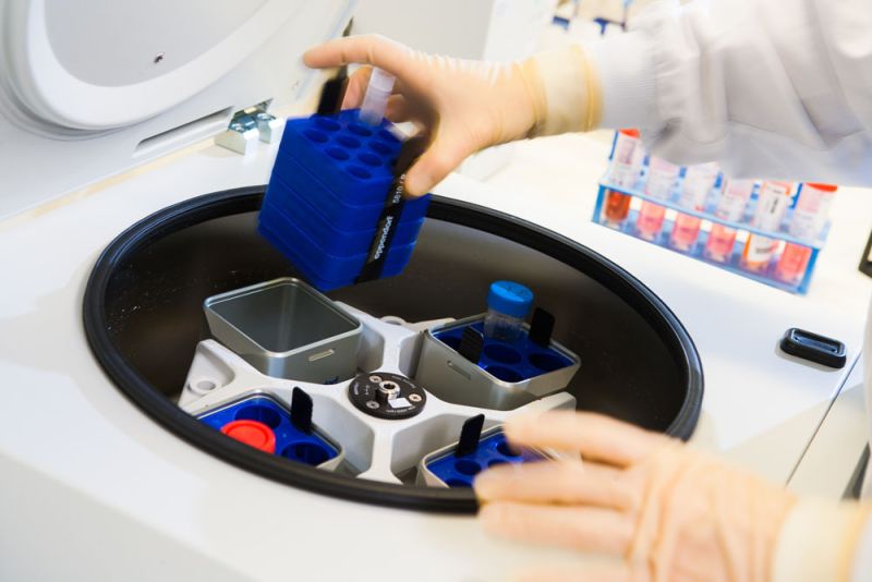 plaatsen-in-centrifuge-labpon-5dfadd3d image Onderzoek baarmoederhalskanker plaatsen-in-centrifuge-labpon-5dfadd3d Onderzoek baarmoederhalskanker