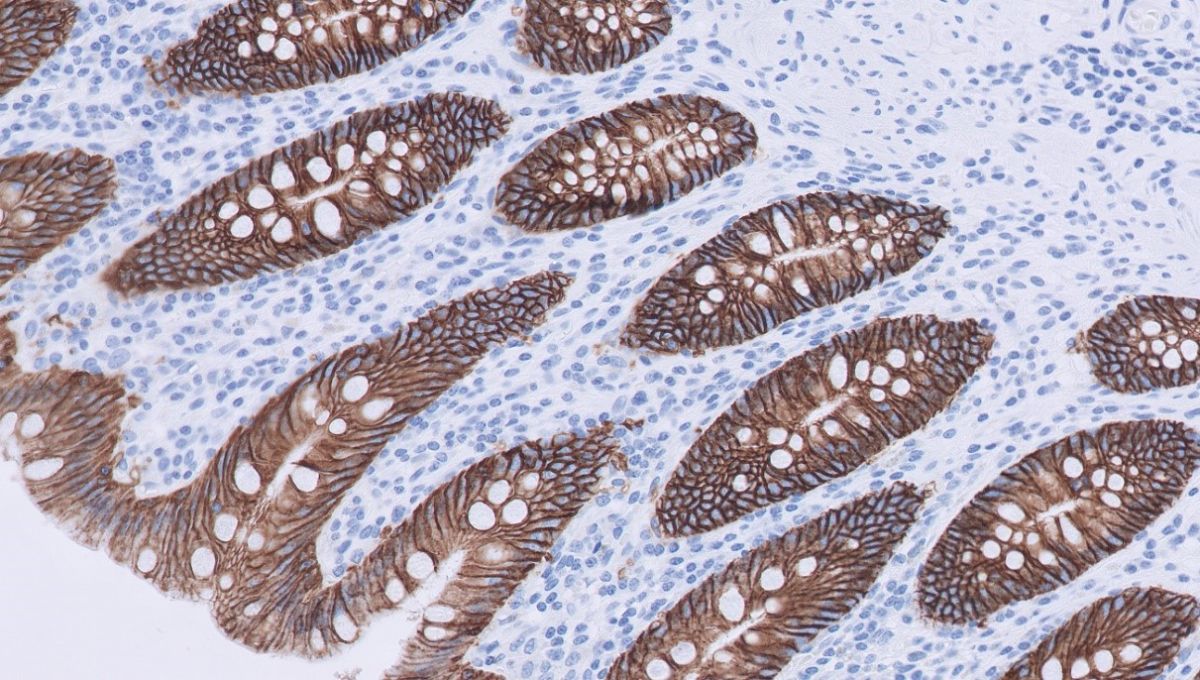 immunologie-3-6ebffab0 image Immunopathologie Foto 3 : EPCAM membraneuze kleuring, binnen oppervlak (epitheel) darmweefsel.