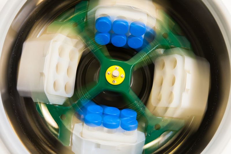 cetrifugeren-materiaal-labpon-842622db image Onderzoek baarmoederhalskanker cetrifugeren-materiaal-labpon-842622db Onderzoek baarmoederhalskanker